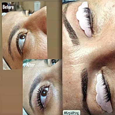 hizmetdetay/kirpik-lifting